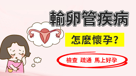 輸卵管1.jpg